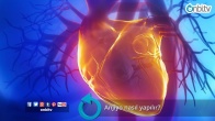 Anjiyo nasıl yapılır?
