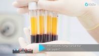PRP tedavisi hangi hastalıklar için yapılır?