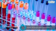 Hasta anjiyoya nasıl hazırlanır?