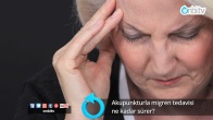 Akupunkturla migren tedavisi ne kadar sürer?