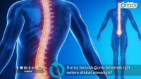 Duruş bozukluğunu önlemek için nelere dikkat etmeliyiz?