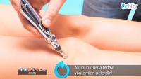 Akupunkturda tedavi yöntemleri ve araçlar nelerdir?