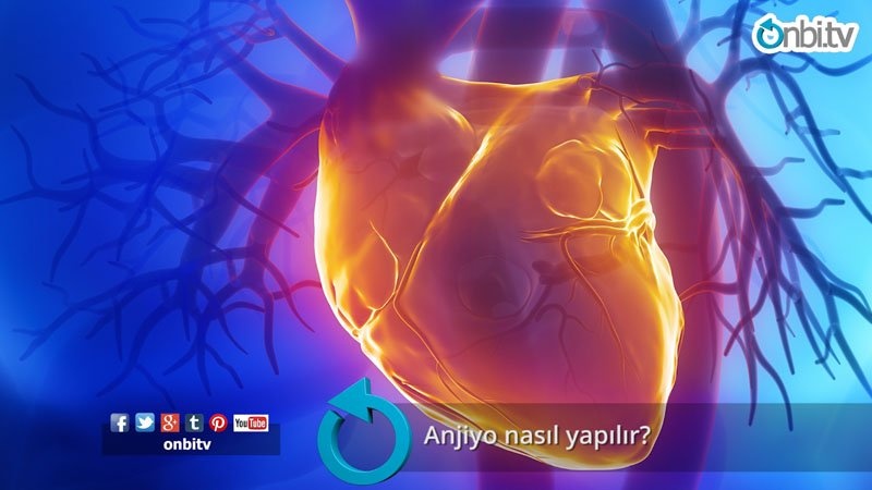 Anjiyo nasıl yapılır?