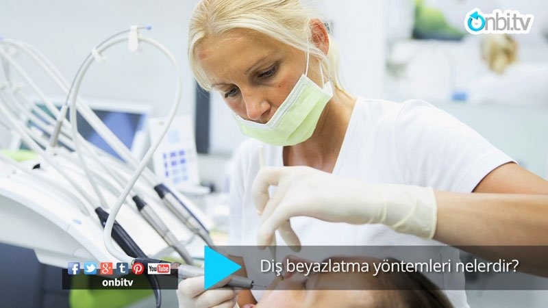 Diş beyazlatma yöntemleri nelerdir?