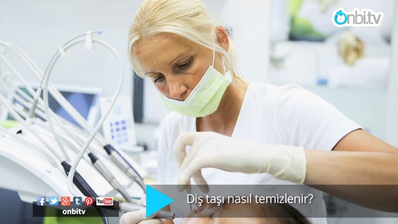 Diş taşı nasıl temizlenir?