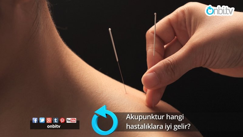 Akupunktur hangi hastalıklara iyi gelir?