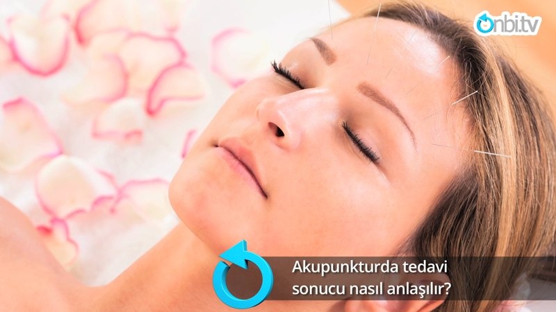 Akupunkturda tedavi sonucu nasıl anlaşılır?