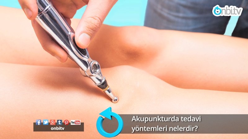 Akupunkturda tedavi yöntemleri ve araçlar nelerdir?