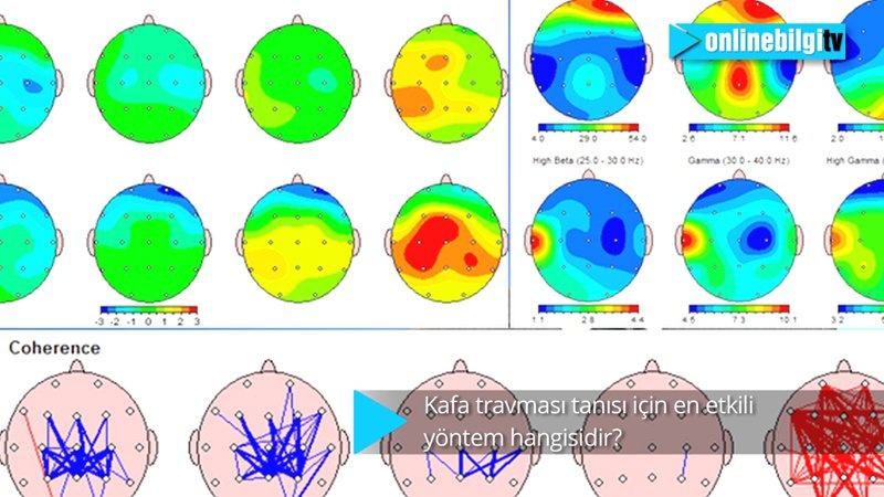 Kafa travması tanısı için en etkili yöntem nedir?